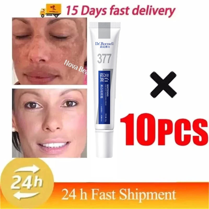 Effective Whitening Freckles Cream for Dark Spots