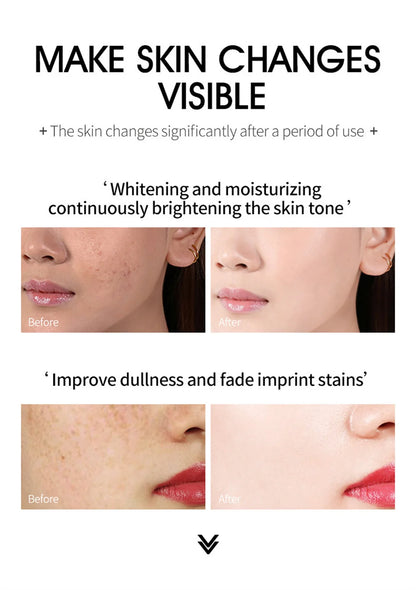 Effective Whitening Freckles Cream for Dark Spots