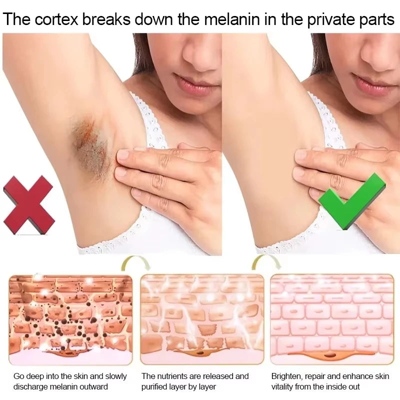 Body Whitening Cream for Arms, Thighs, and Underarms