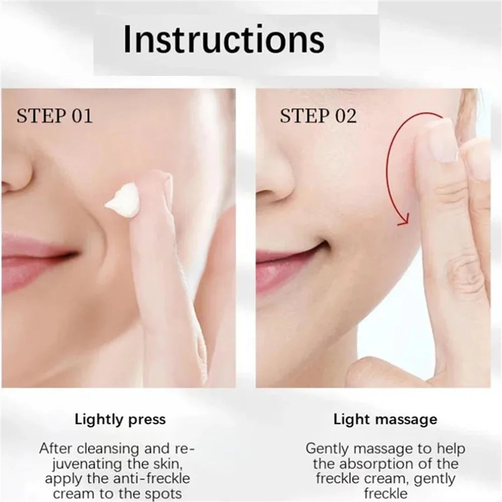 Effective Whitening Freckles Cream for Dark Spots