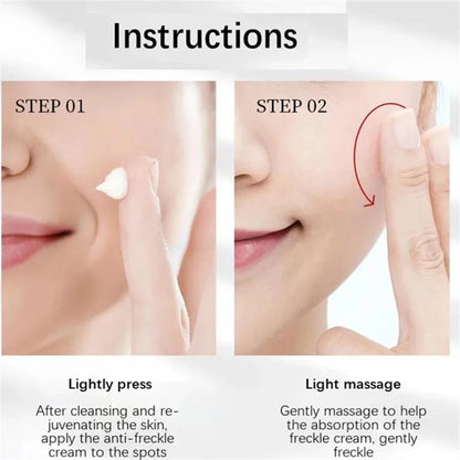 Effective Whitening Freckles Cream for Dark Spots