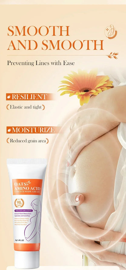 Stretch Mark Removal Cream for Postpartum Care