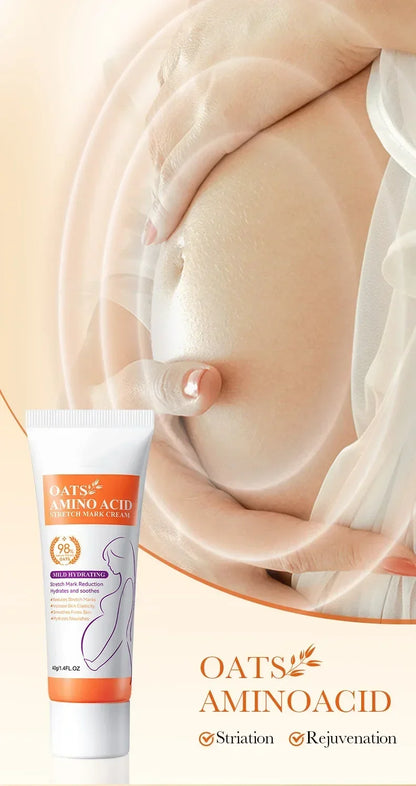 Stretch Mark Removal Cream for Postpartum Care