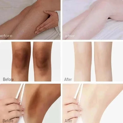 Body Whitening Cream for Arms, Thighs, and Underarms