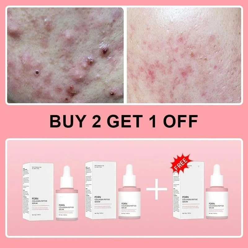Collagen Peptide Facial Serum for Dull Skin