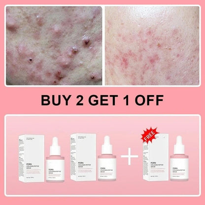 Collagen Peptide Facial Serum for Dull Skin