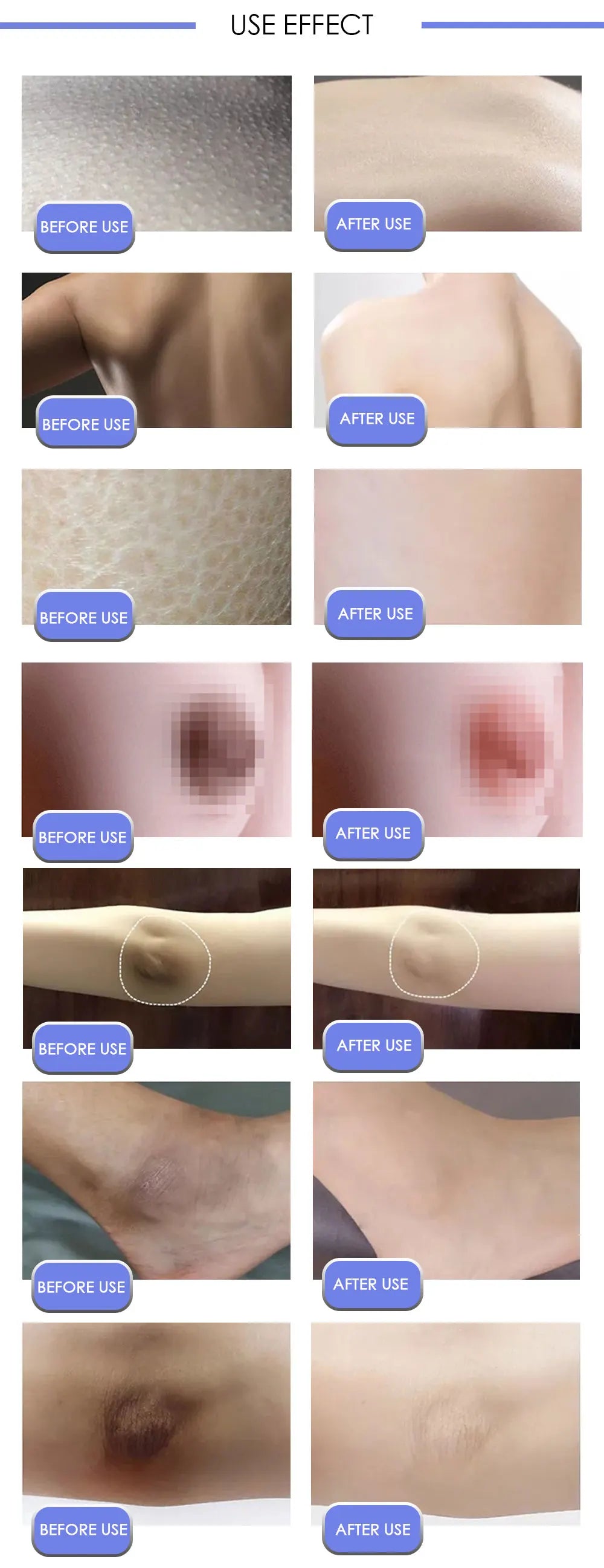 Brightening Body & Underarm Cream