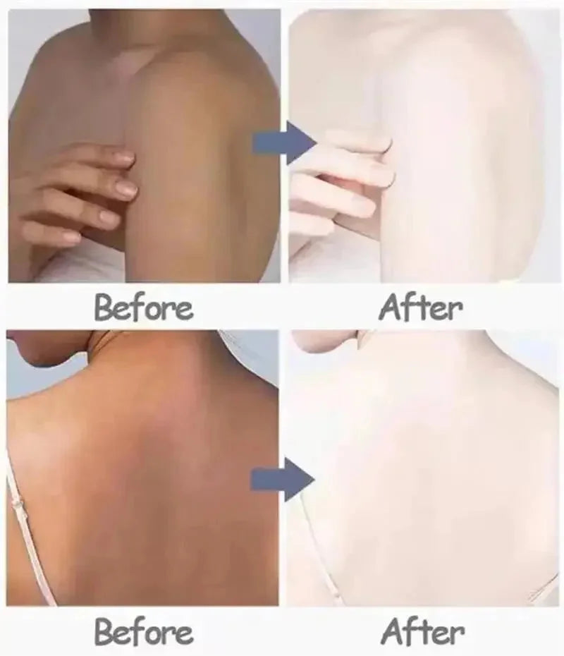 Body Whitening Cream for Private Parts and Underarms