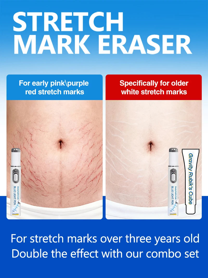 Blue Light Pen for Stretch Marks and Skincare Tools