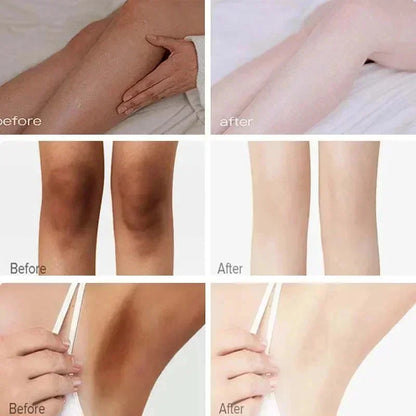 Body Whitening Cream for Private Parts and Underarms
