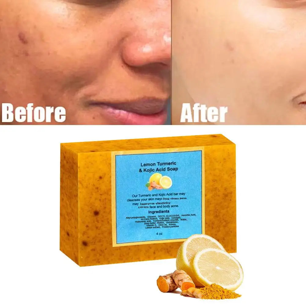 Turmeric & Lemon Whitening Soap