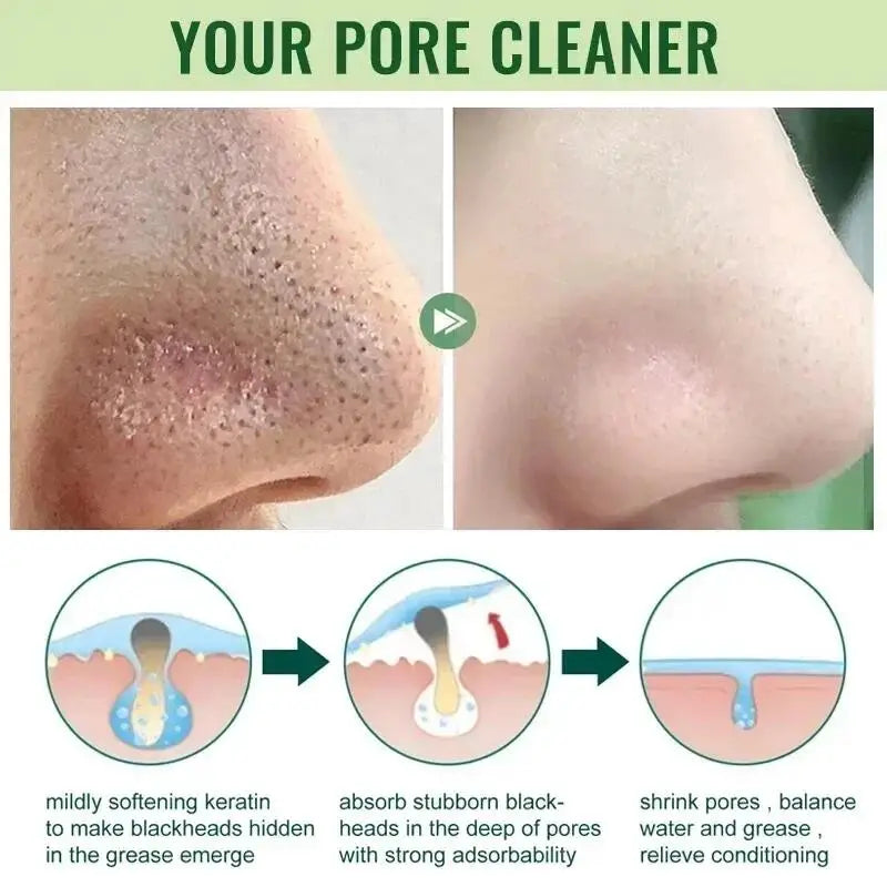 Green Tea Solid Mask for Acne and Blackhead Removal