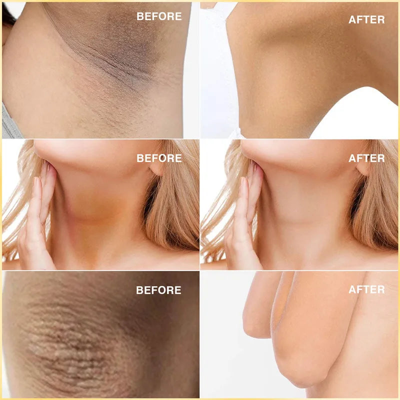 Brightening Body & Underarm Cream