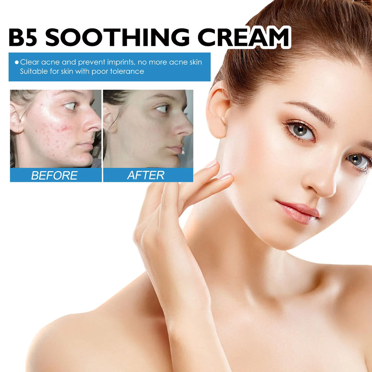 B5 Moisturizing Cream for Dry Chapped Skin