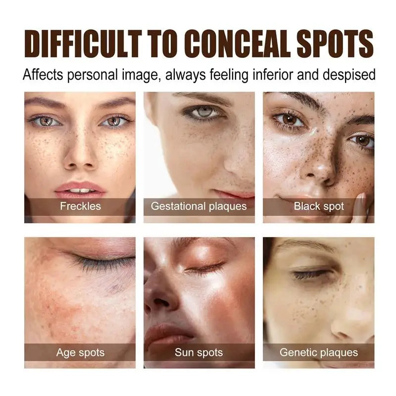 Nicotinamide Whitening Freckle Cream for Dark Spots