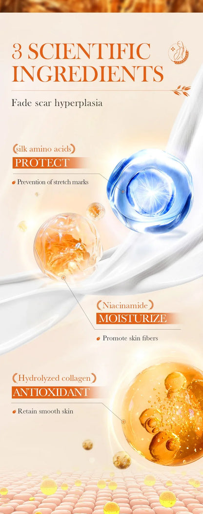 Stretch Mark Removal Cream for Women