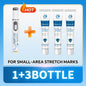 Blue Light Pen for Stretch Marks and Skincare Tools