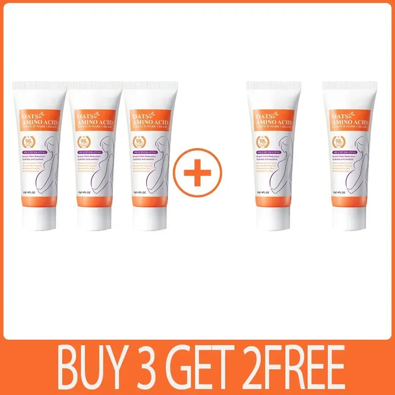 Stretch Mark Removal Cream for Postpartum Care