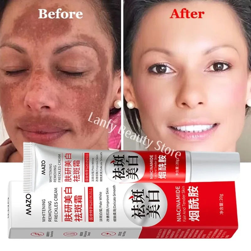 Nicotinamide Whitening Freckle Cream for Dark Spots