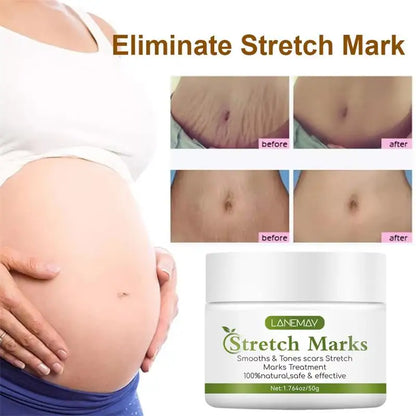 Stretch Marks Removal Cream for Maternity Care