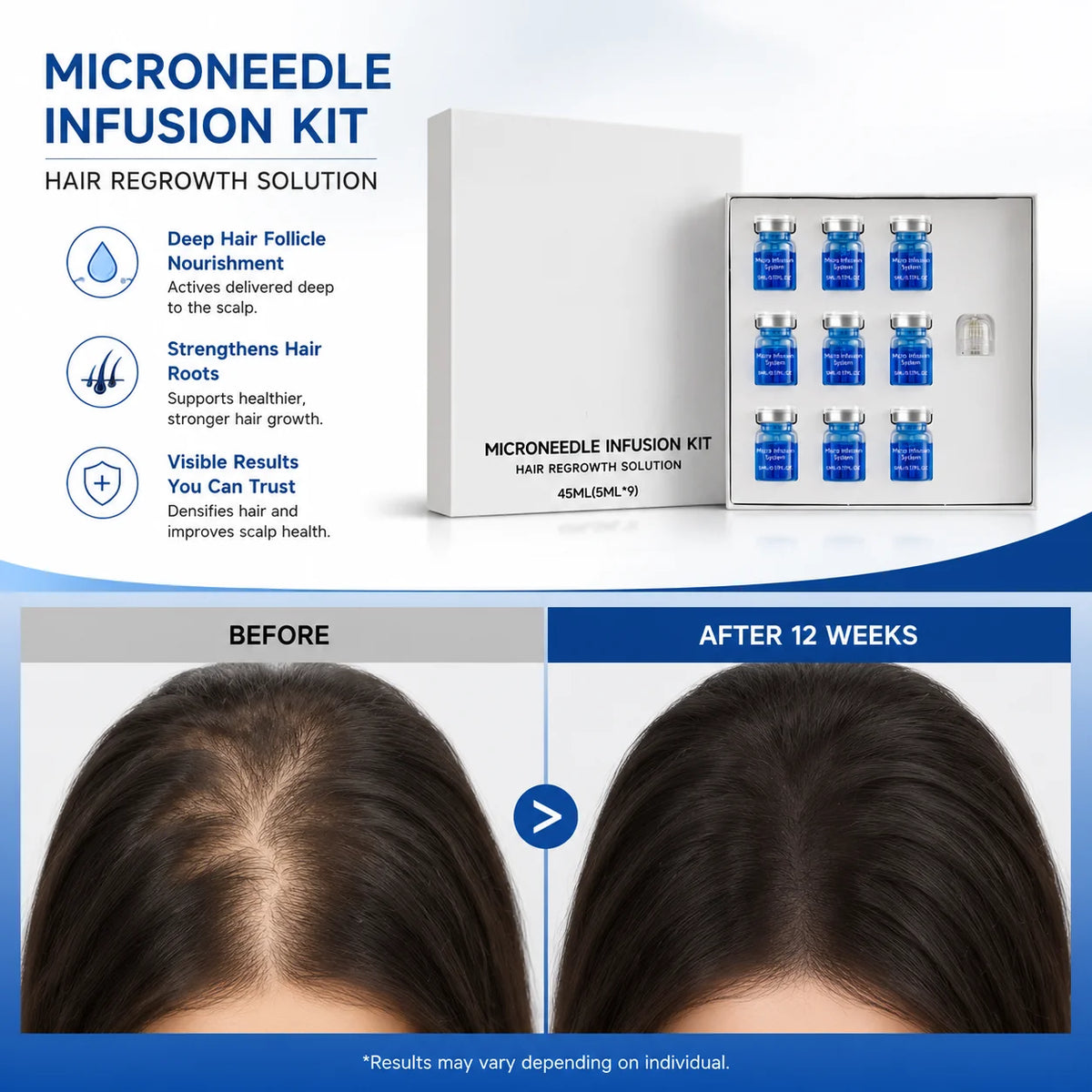 Microneedle Hair Regrowth Kit with Nourishing Serum