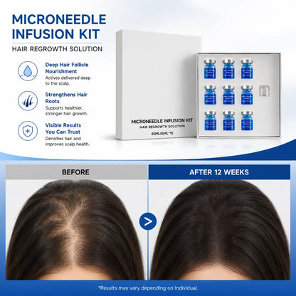Microneedle Hair Regrowth Kit with Nourishing Serum