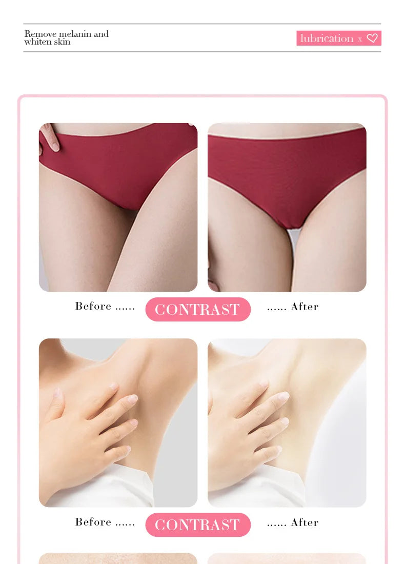 Body Whitening Cream for Arms, Thighs, and Underarms