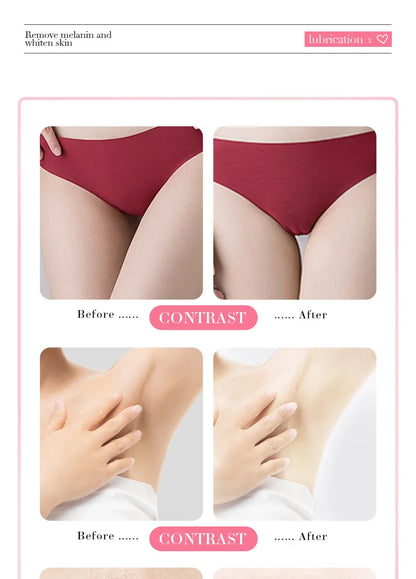 Body Whitening Cream for Arms, Thighs, and Underarms