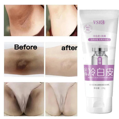 Body Whitening Cream for Private Parts and Underarms