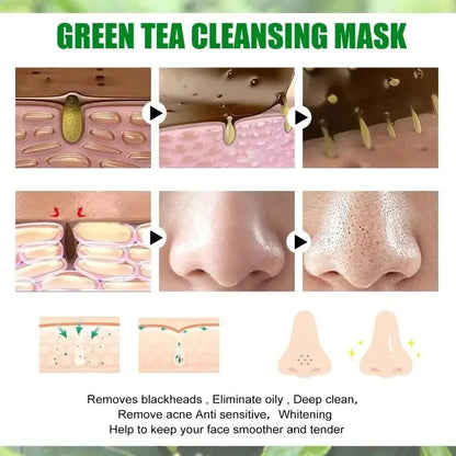 Green Tea Solid Mask for Acne and Blackhead Removal