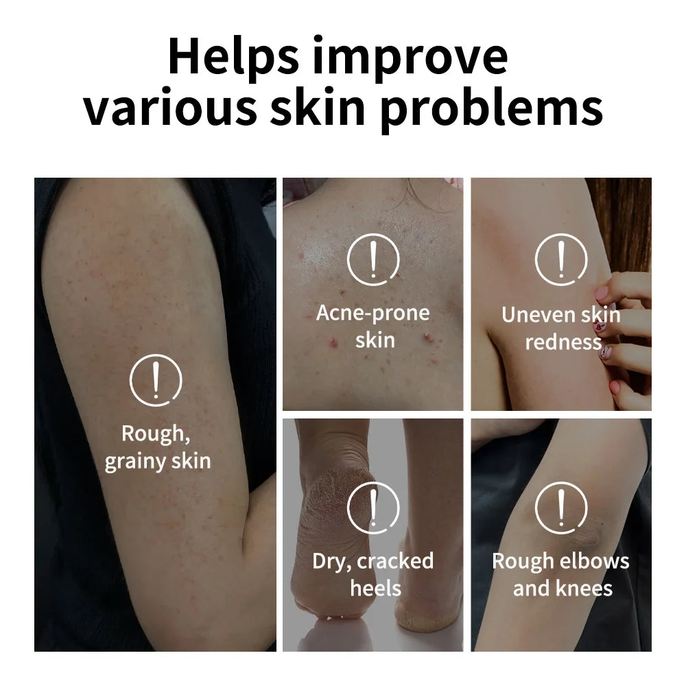 Glycolic Acid Exfoliating Body Stick 18g