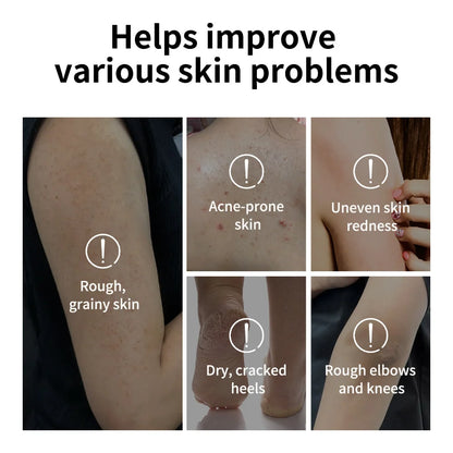 Glycolic Acid Exfoliating Body Stick 18g
