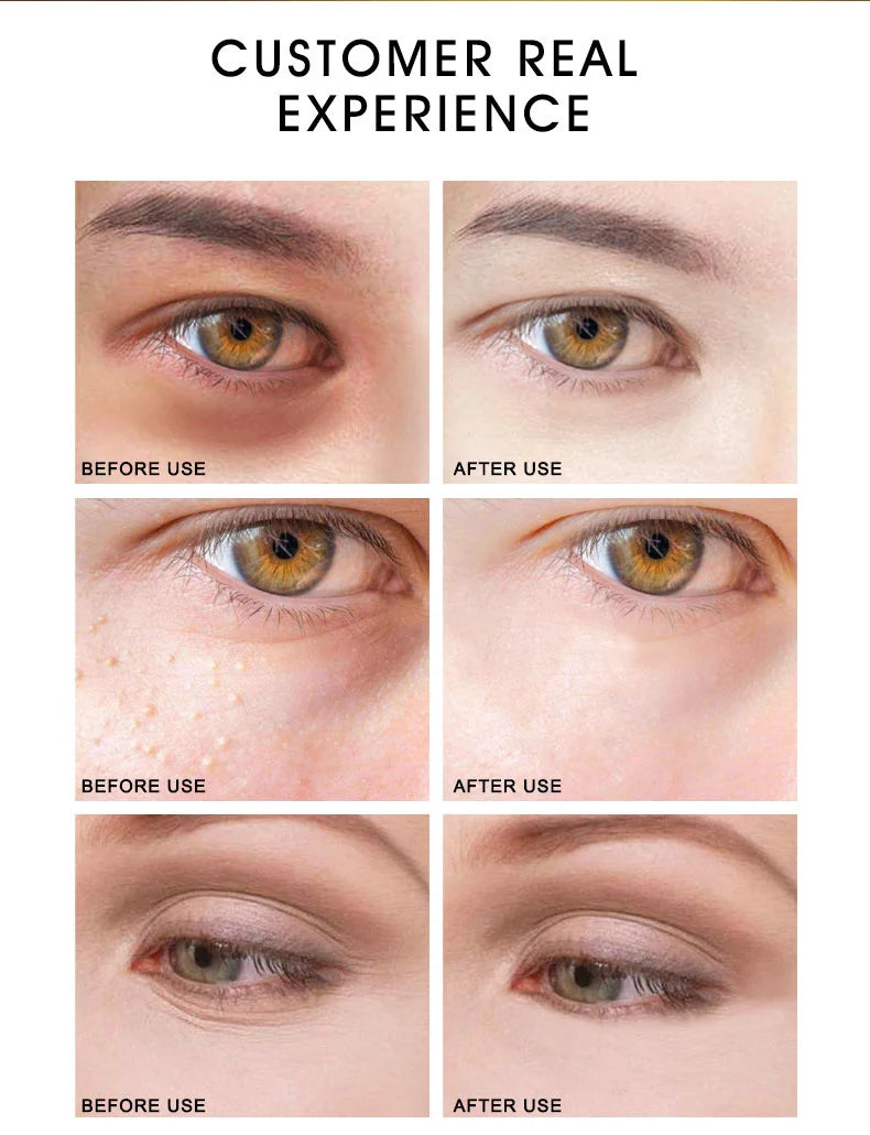 ARTISCARE 24K Gold Serum Set for Eye and Face Care