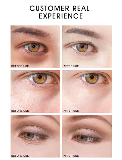 ARTISCARE 24K Gold Serum Set for Eye and Face Care