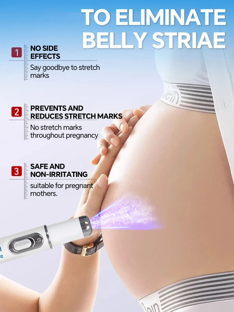 Blue Light Pen for Stretch Marks and Skincare Tools
