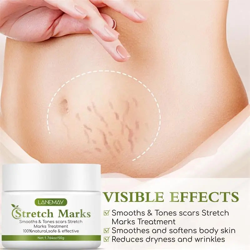 Stretch Marks Removal Cream for Maternity Care
