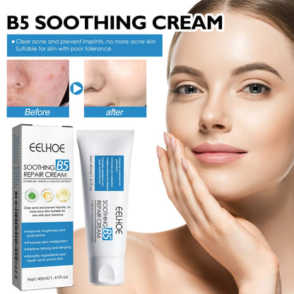 B5 Moisturizing Cream for Dry Chapped Skin