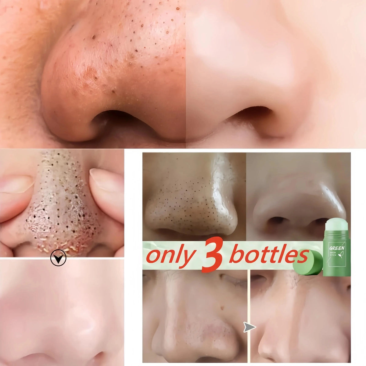 Green Tea Solid Mask for Acne and Blackhead Removal