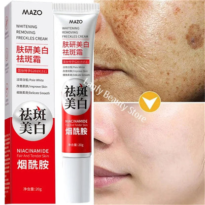 Nicotinamide Whitening Freckle Cream for Dark Spots