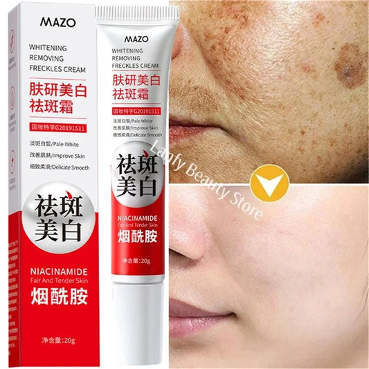 Nicotinamide Whitening Freckle Cream for Dark Spots