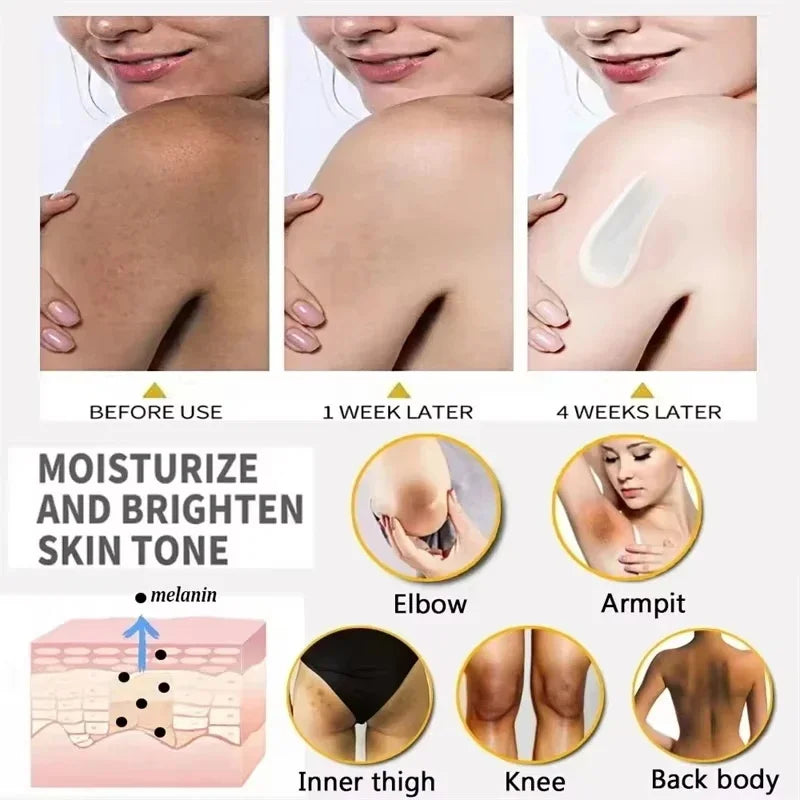Body Whitening Cream for Arms, Thighs, and Underarms