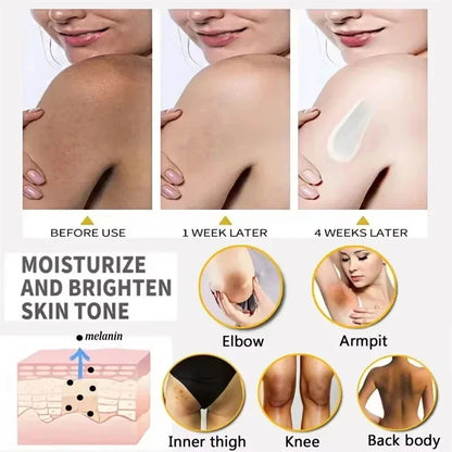 Body Whitening Cream for Arms, Thighs, and Underarms