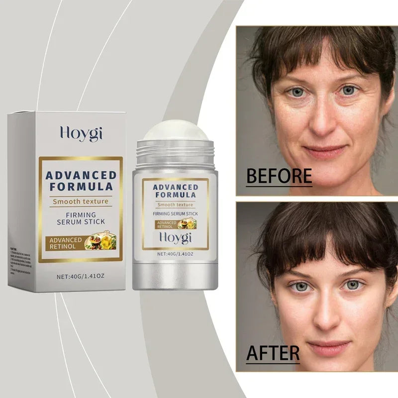 Retinol Hyaluronic Acid Stick Anti Wrinkle Balm