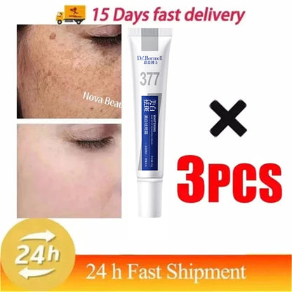 Effective Whitening Freckles Cream for Dark Spots