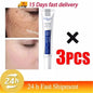 Effective Whitening Freckles Cream for Dark Spots