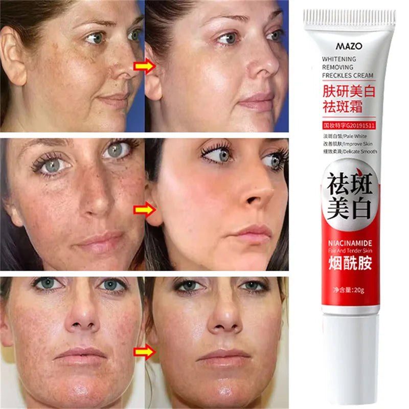 Nicotinamide Whitening Freckle Cream for Dark Spots
