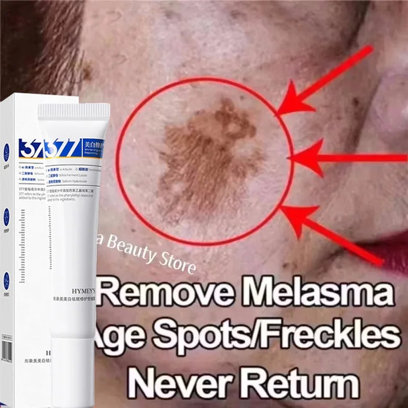 Effective Whitening Freckles Cream for Dark Spots