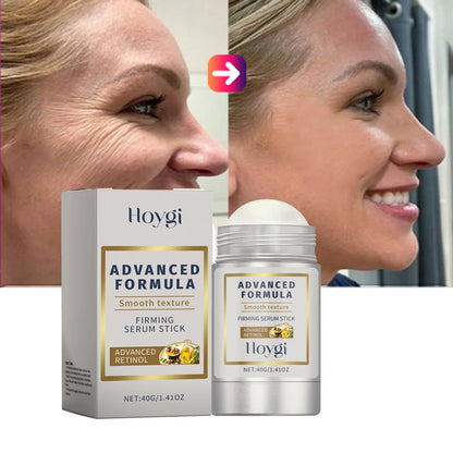 Retinol Hyaluronic Acid Stick Anti Wrinkle Balm