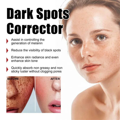 Effective Whitening Freckles Cream for Dark Spots