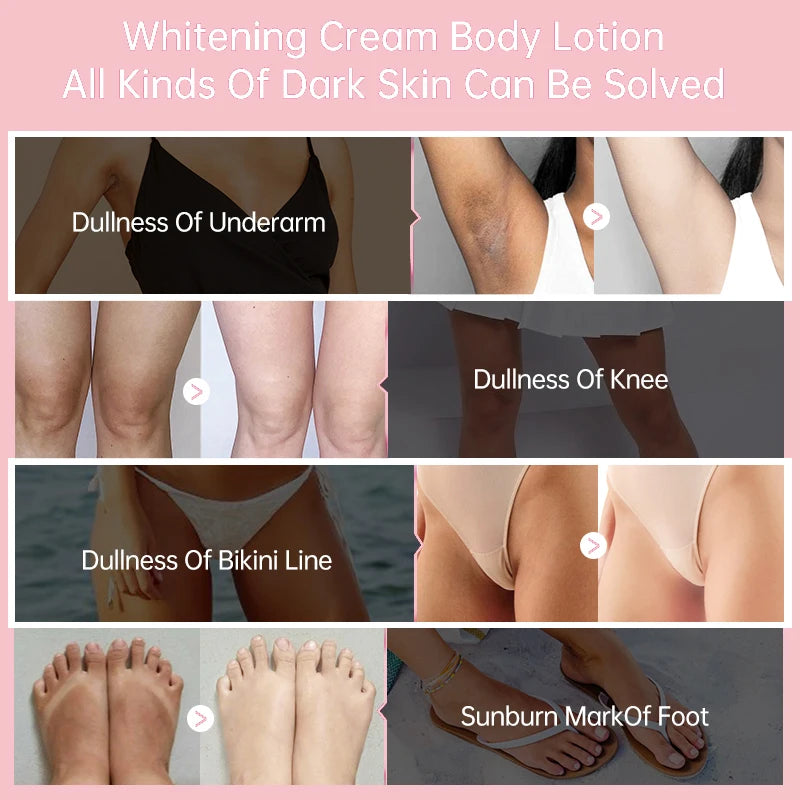 Body Whitening Cream for Private Parts and Underarms